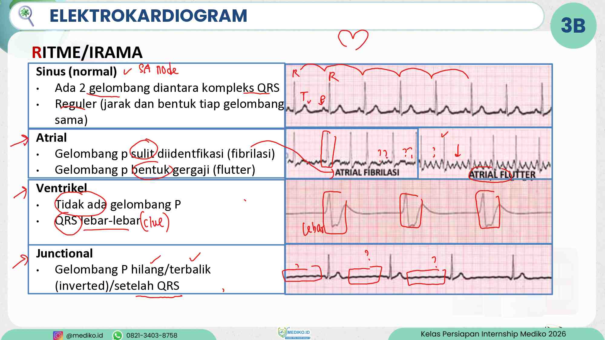 [coretan]-persiapan-internship---review-acls---dr.-hadi-393